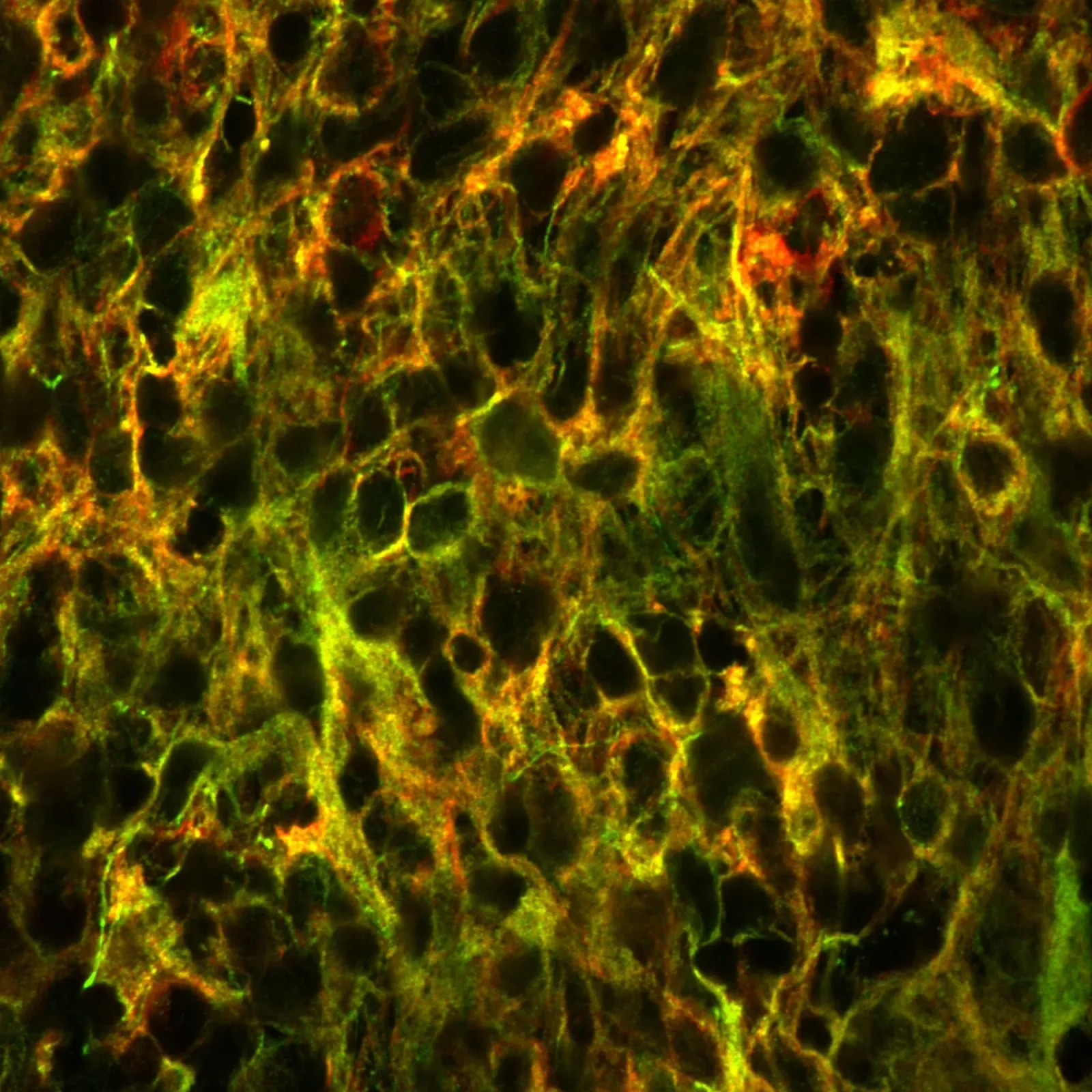 Amyloid fibers in semen carry genetic cargo into sperm and early embryos