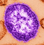 Pennsylvania warns doctors about surge in congenital measles