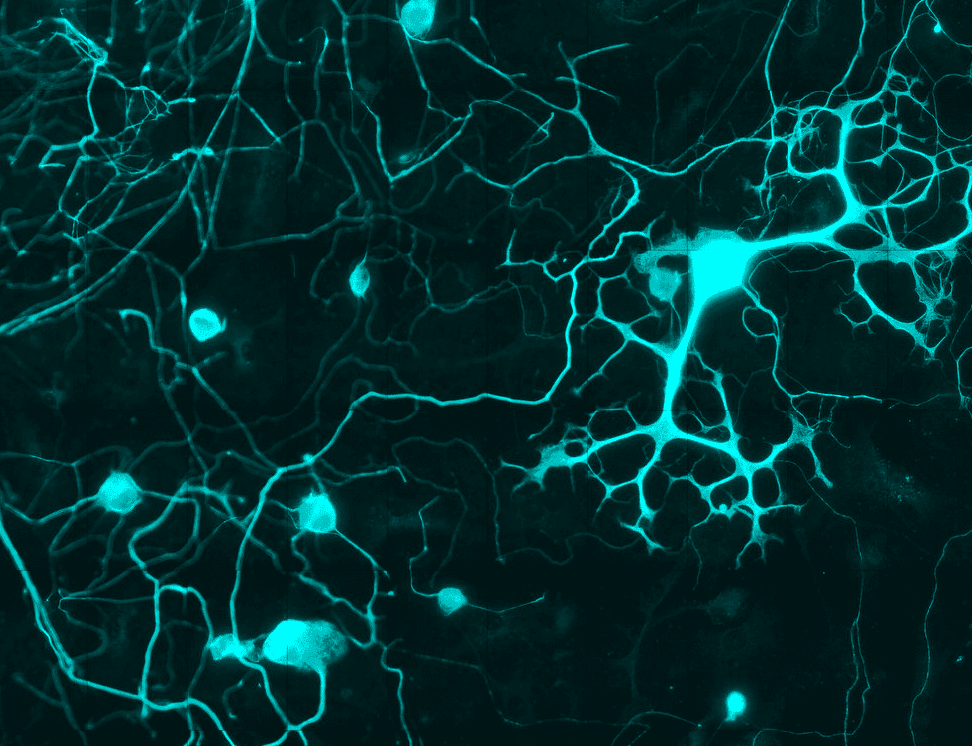 Cancer and neurodegeneration reveal an uneasy biological trade-off