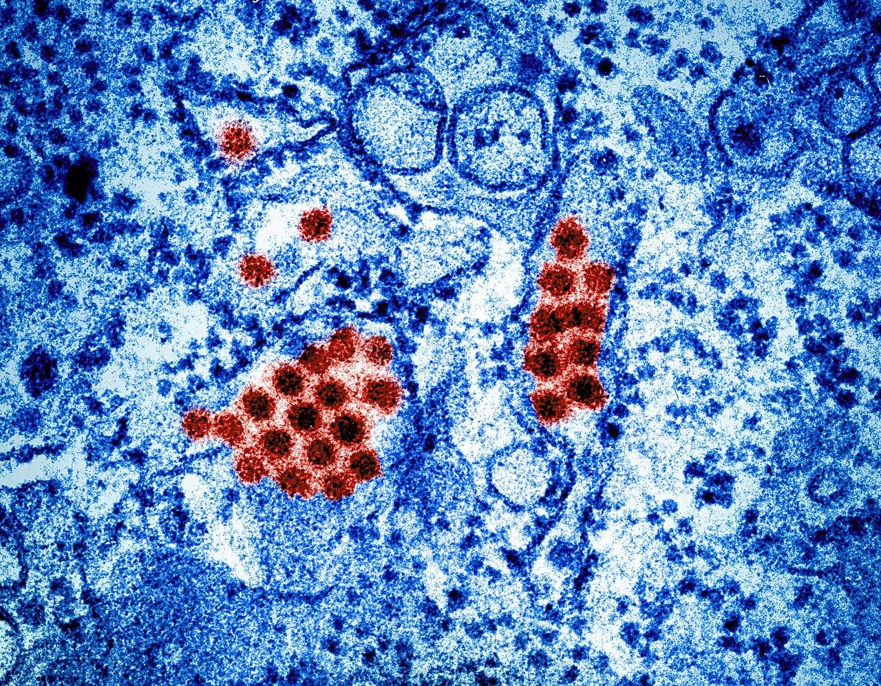 Dengue virus can replicate inside protective human memory B cells