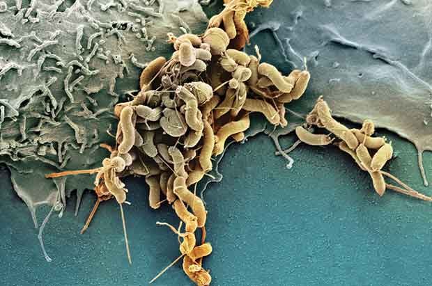 Infections cause one in eight cancers worldwide and most are preventable