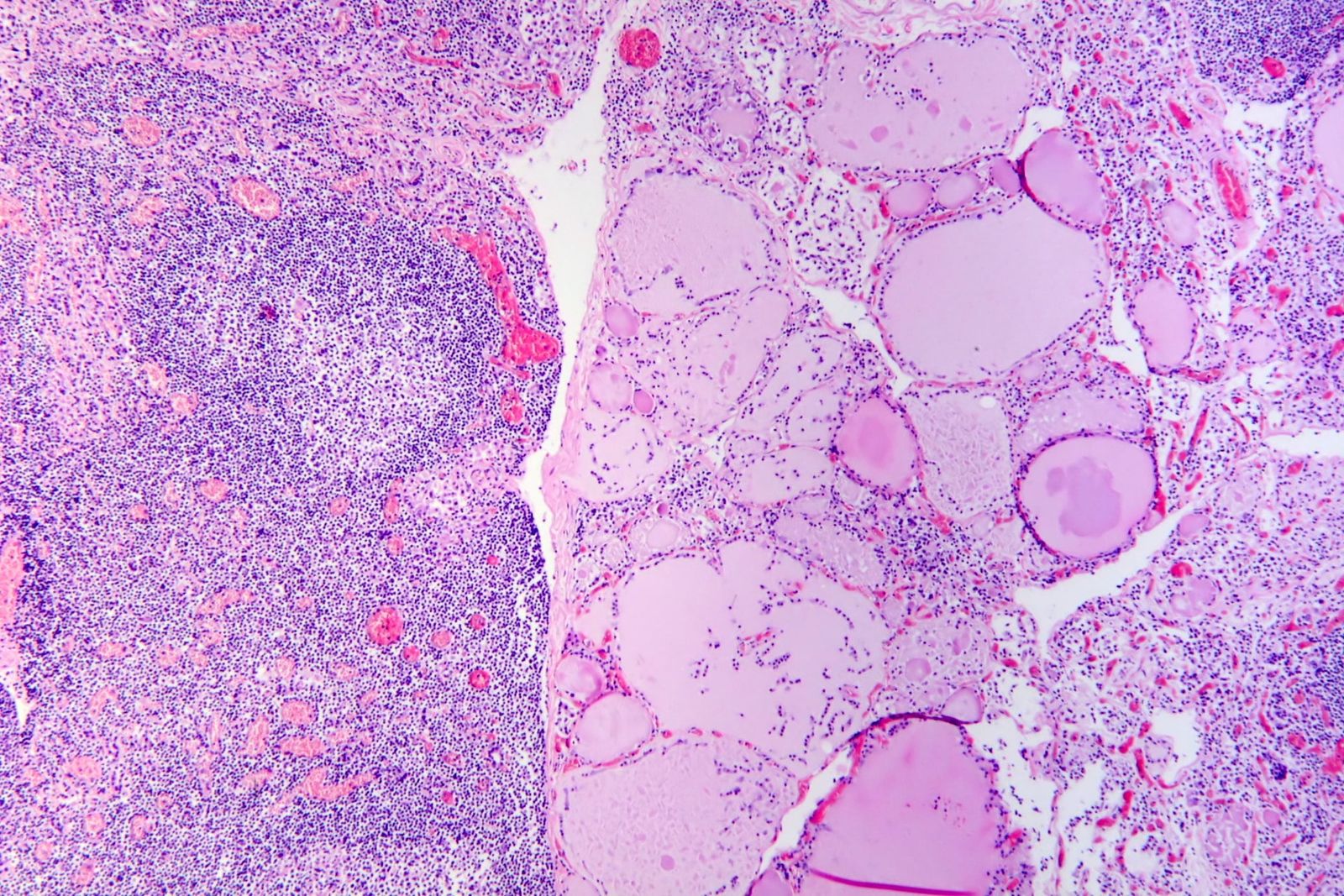 Misfolded immune defences can penetrate growing cells and disarm DNA repair