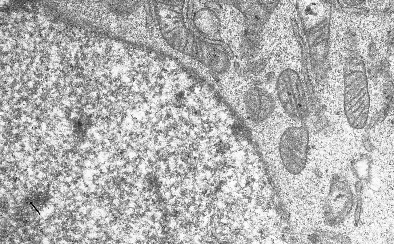 Shielding fruit flies from Earth magnetic field extends lifespan for some
