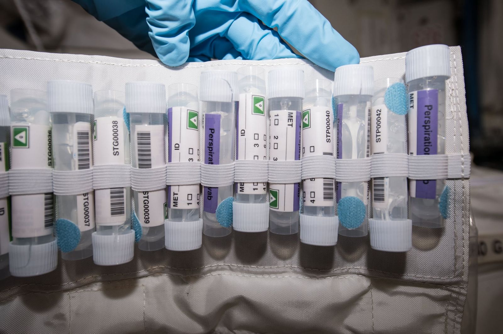 Gut microbes linked to brain health reflect only narrow populations