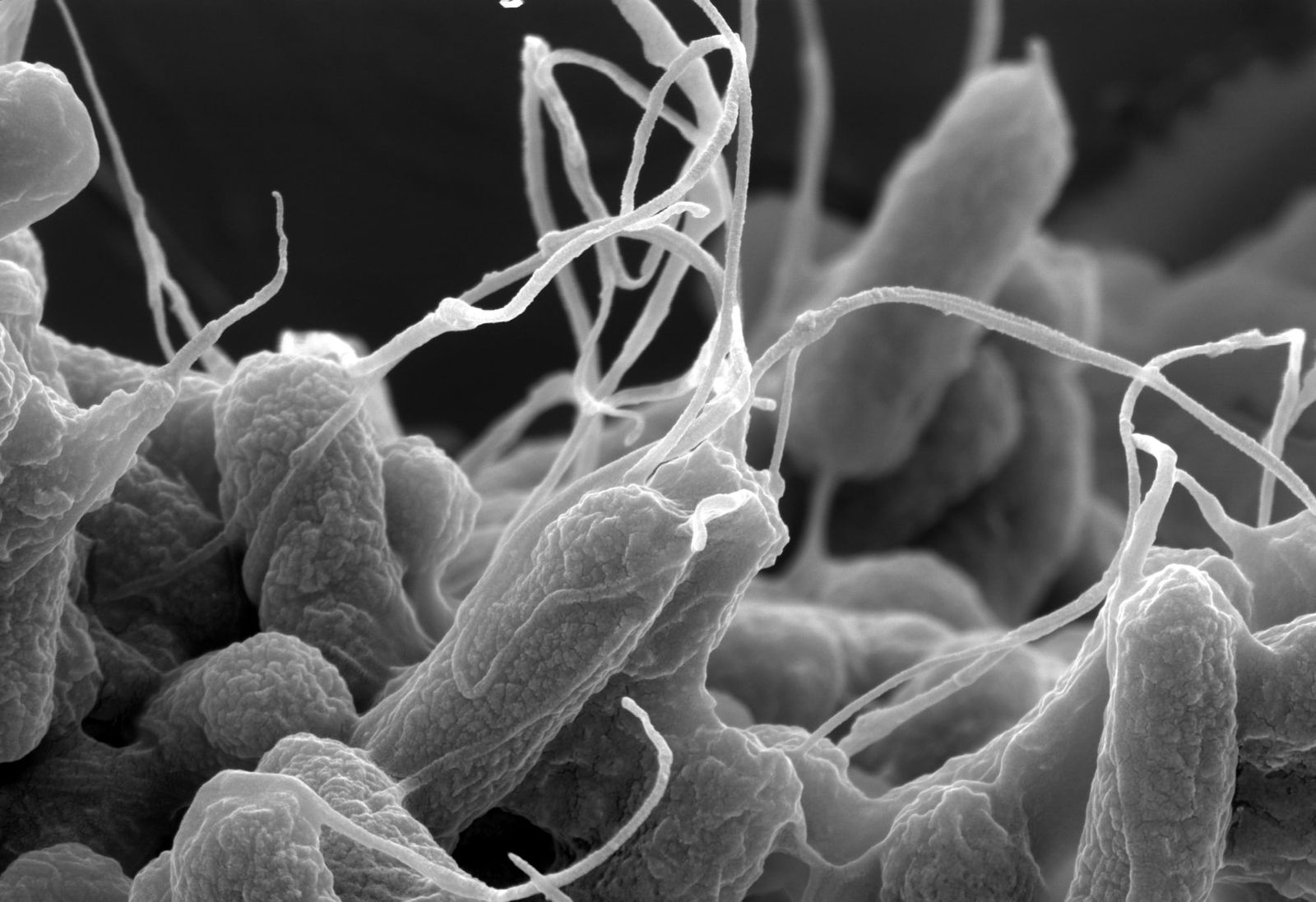 Bacterial gene loss can make cells grow faster