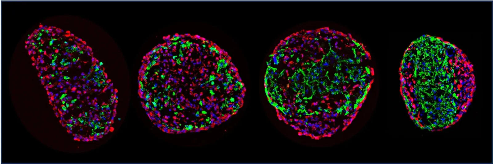 Spheres of living cells and automated vision map the skin barrier