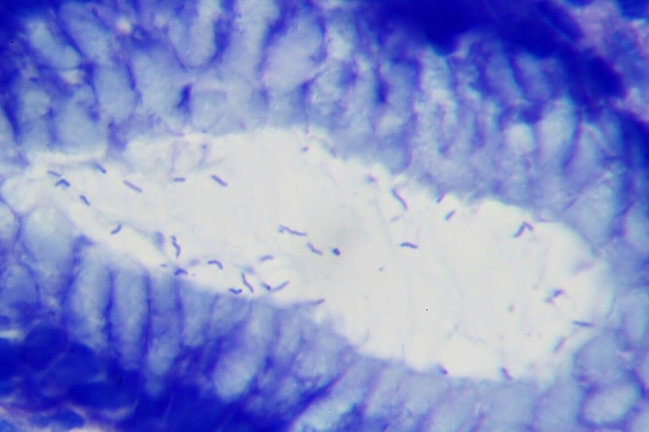Infections cause one in eight cancer cases across the world