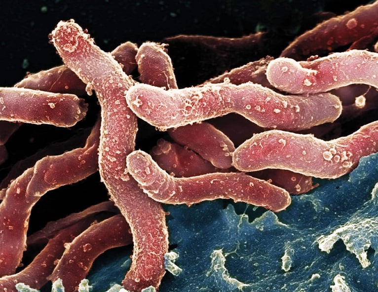 Infections cause one in eight cancers worldwide and most are preventable